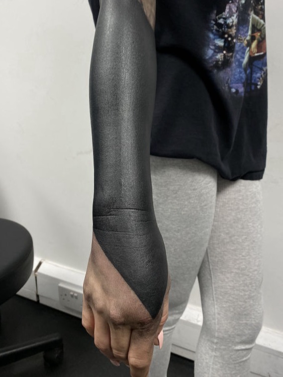 Blackout forearm and hand tattoo